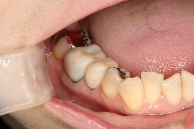 IMG_5668_R1.jpg