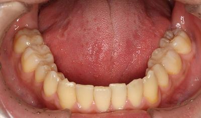 IMG_0685_R5.jpg