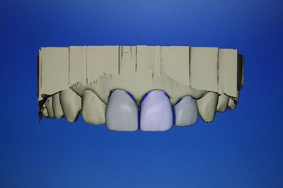 IMG_8545R5.jpg