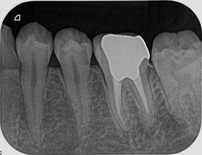 2013.01.16R7.jpg
