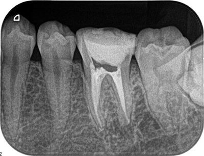 2013.02.15R7.jpg