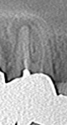 1CT_20130301192617_Image0011.jpg