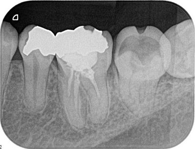 2013.03.06R7.jpg