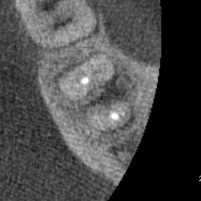 00351_2013_05_10_CTR071.jpg