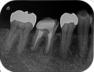 2013.06.22R071.jpg