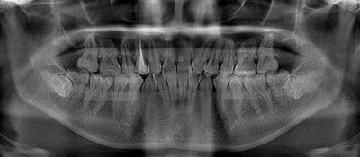 CT_20130612203946R071.jpg