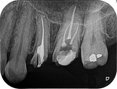 2013.09.11R075.jpg
