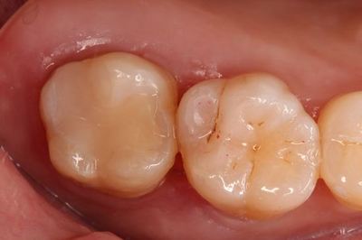 IMG_79533R077.jpg