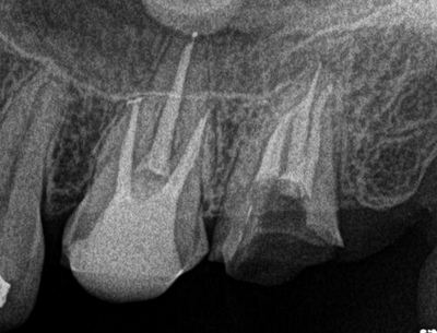2014.03.18R78.jpg