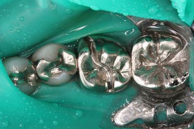 IMG_1204R78.jpg
