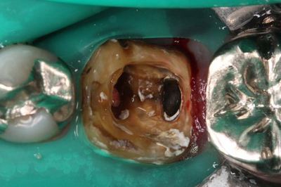 IMG_1207R78.jpg