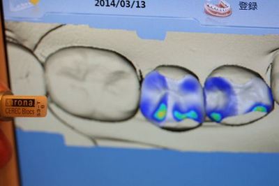 IMG_1395R78.jpg