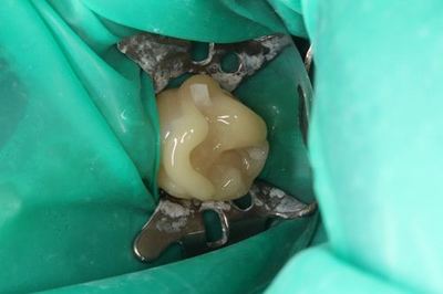 IMG_1674R78.jpg