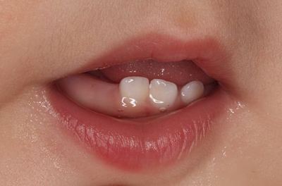IMG_1895R78.jpg
