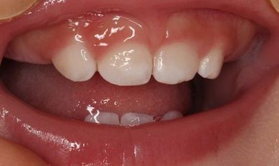 IMG_3645R78.jpg