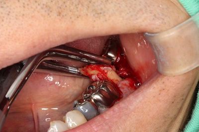 IMG_5722R79.jpg