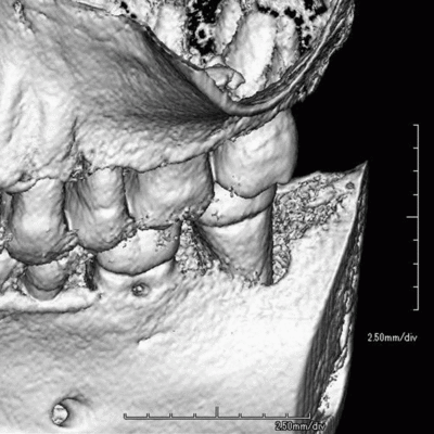 3D2014.07.05.gif