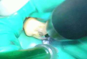 超音波洗浄2014.07.05.gif
