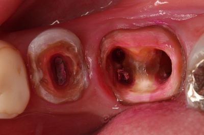 IMG_9604R79.jpg