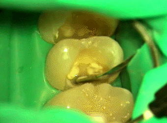 周囲CR2014.08.06.gif