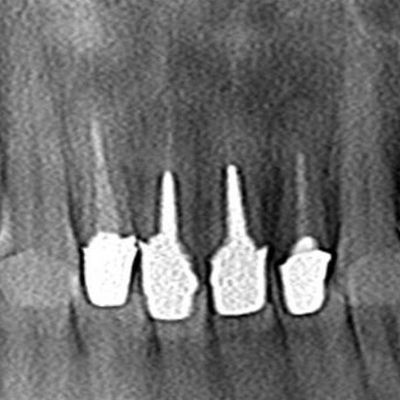 CT_20141016212556R80.jpg