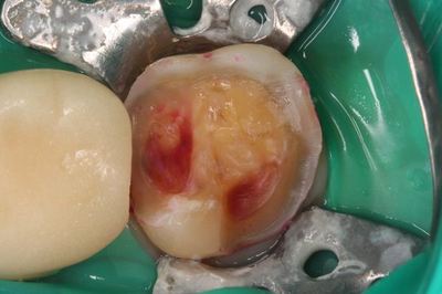 IMG_3769R80.jpg
