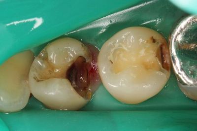 IMG_7352R82.jpg