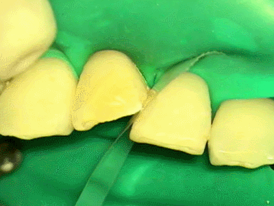 光照射2015.02.09.gif