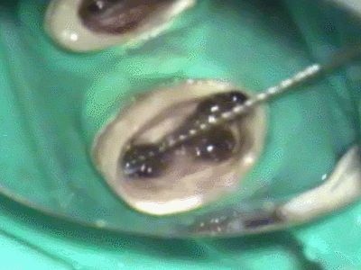 GP-SOLVENTジーピーソルベント使用動画2015.03.07.gif