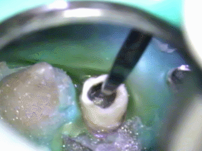 先端が取れた瞬間2015.03.17.gif