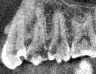 CT_20150528212706_R85.jpg