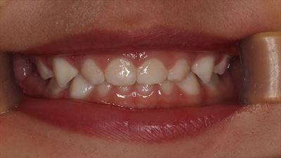 IMG_5462_R85.JPG