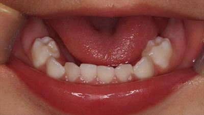 IMG_5470_R85.JPG