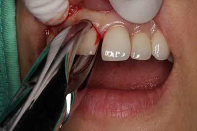 IMG_6542_R85.JPG