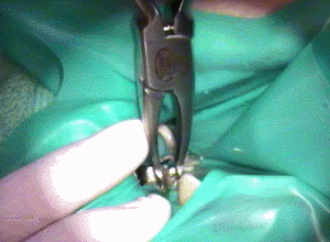 メタルコアの取れる瞬間2015.06.10.gif