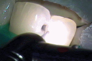 古いCRの切削2015.06.03.gif