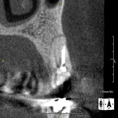 CT_20150710130654_R85.jpg