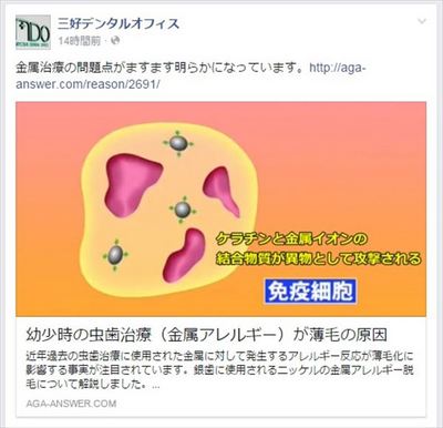 金属治療で薄毛に？_R88.jpg