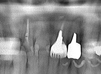 CT_20151024234437.jpg