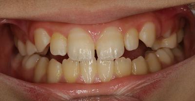 IMG_3347_R85.JPG