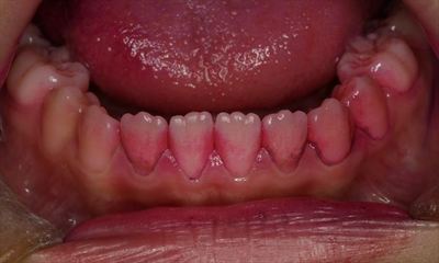 IMG_3356_R85.JPG