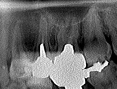 CT_20160112215536_R85.jpg