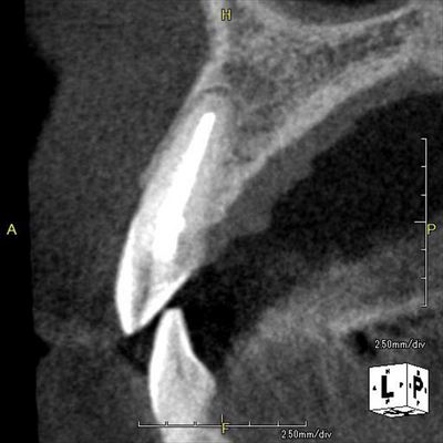 CT_20160113231455_R85.jpg