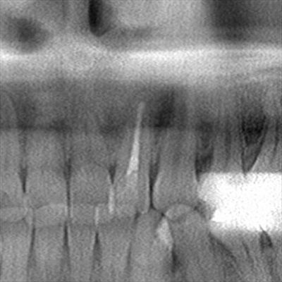 CT_20160113232618_R85.jpg
