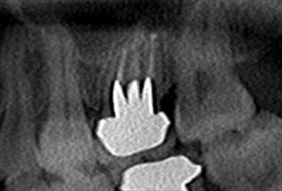CT_20160114221553_R85.jpg