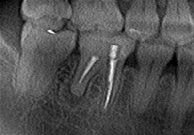 CT_20160122205530_R21.jpg
