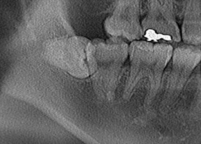 CT_20160204221626_R21.jpg