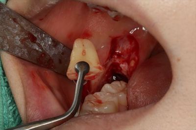 IMG_5169_R21.JPG