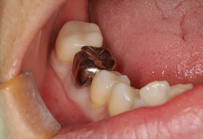IMG_5602_R21.JPG