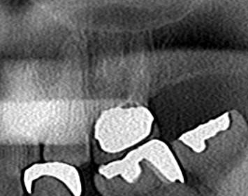 CT_20160323222411.jpg